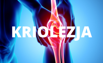 Kriolezja – skuteczna metoda leczenia bólu