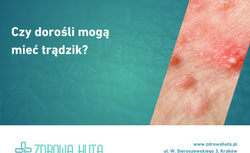 Trądzik u dorosłych – przyczyny, objawy i leczenie


