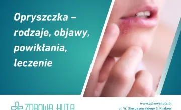 Opryszczka – rodzaje, objawy, powikłania, leczenie